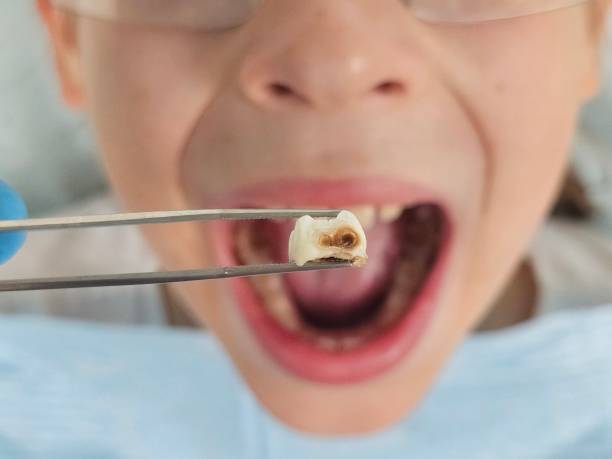 Best Emergency Tooth Extraction  in De Motte, IN